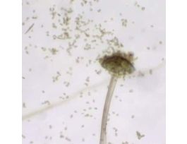 Prepared Slide, Bread Mold