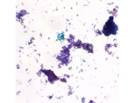 Prepared Slide, Budding Yeast