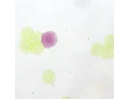 Prepared Slide, Ascaris (Roundworm), Egg, Cs