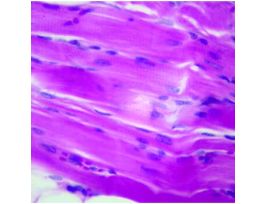 Prepared Slide, Skeletal Muscle, Cs and Ls
