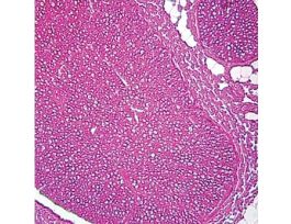 Prepared Slide, Nerve Cells, Animal