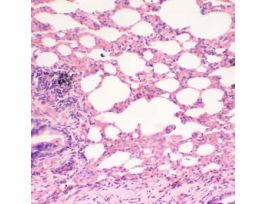 Prepared Slide, Human Lung Tissue, Normal