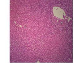 Prepared Slide, Human Liver Cells, Normal