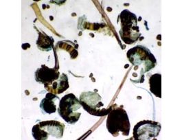 Prepared Slide, Fern Spores Germinating