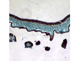 Prepared Slide, Lichen, Sec