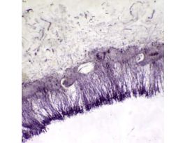 Prepared Slide, Molds, Aspergillus, Penicillium, and Rhizopus
