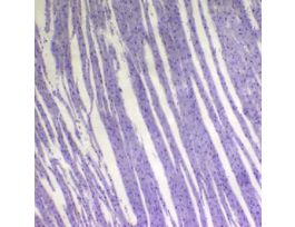 Prepared Slide, Muscle, 3 Types