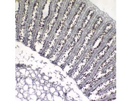 Prepared Slide, Mushroom, Cs
