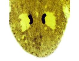 Prepared Slide, Planaria