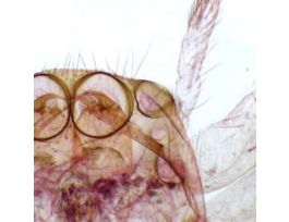 Prepared Slide, Spider, Wm