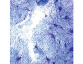 Prepared Slide, Multi-Polar Motor Neurons
