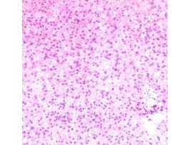 Prepared Slide, Frog Liver, Sec