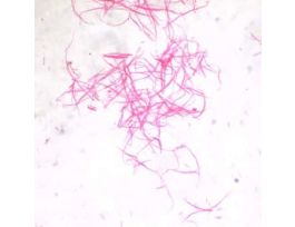 Prepared Slide, Involuntary Smooth Muscle, Ls and Cs