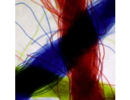 Prepared Slide, Threads, Colored, Crossed, Wm