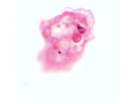 Prepared Slide, Amoeba Proteus
