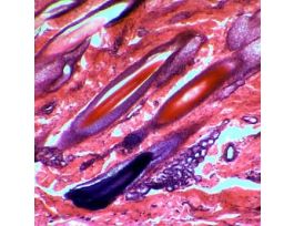 Prepared Slide, Human Scalp, Vs