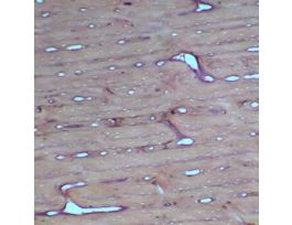 Prepared Slide, Compact Bone, Cs