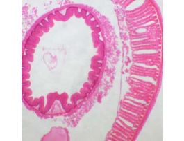 Prepared Slide, Earthworm, Posterior, Cs