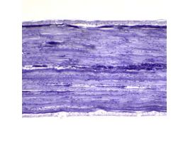 Prepared Slide, Striated Muscle, Ls