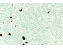 CONTROL WITHOUT HYDROLYSIS F&FG NECTURUS