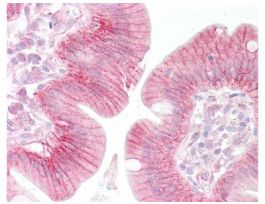 BETA CATENIN ANTIBODY 25UL
