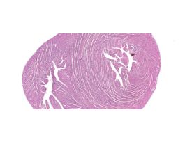 HEART (CS) H&E M THROUGH VENTRICLES.