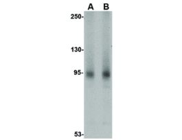 AAK1 N-TERM ANTIBODY 100 UG