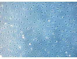 HDLEC-c: Human Dermal Lymphatic Endothelial Cells (HDLEC) juvenile foreskin