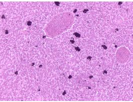 FROG LIVER (SECT) H&E SLIDE