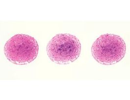FISH EGG DEVELOPMENT (SEC) (IH)