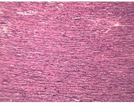 AORTA V&E (HUMAN) ELASTIC TISSUE STAIN