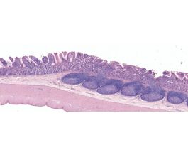 ILEUM-PEYER'S PATCHES H&E (M)MICROVILLI