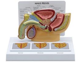 MODEL MALE PELVIS 3D ENLARGED PROSTATES