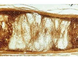 CARTILAGE (MAMMALIAN) ELASTIC SECT