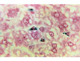 PHAGOCYTOSIS (SECT) TB&NFR LIVER