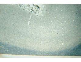 CEREBRUM (SECT) W (HUMAN) VISUAL CORTEX