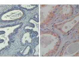 AKT PHOSPHO T308 AB 50UG