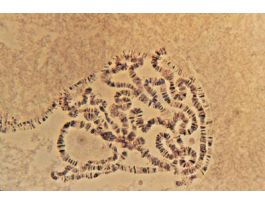Drosophila Chromosomes (SQ) AO