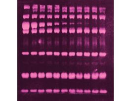 GEL STAIN RUBY PROTEIN SYPRO 200ML