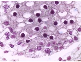 LILIUM ANTHER-SHOWING SYNIZESIS (CS) QS