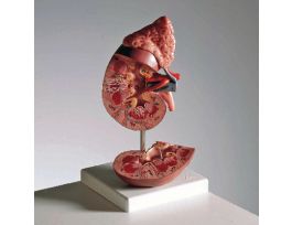 MODEL KIDNEY W/ADRENAL GLAND