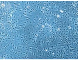 HCAEC-c: Human Coronary Artery Endothelial Cells (HCAEC)