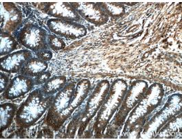 ANTI-PRDX4(MONOCLONAL)