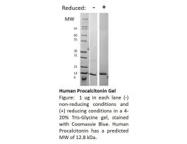 100-164-500UG HUMAN PROCALCITONIN