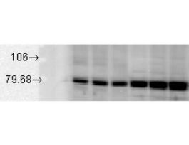 GRP78 ANTIBODY 200UL