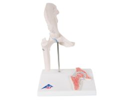 MODEL MINI HIP FOR MINI JOINT SET