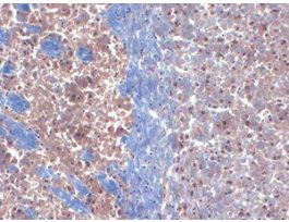 KCHLP3 K+ ANTIBODY 100UG