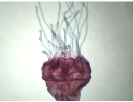 AURELIA-SCYPHISTOMA (WM)