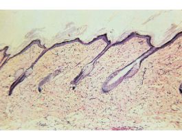 GENERAL HISTOLOGY SET SET/25