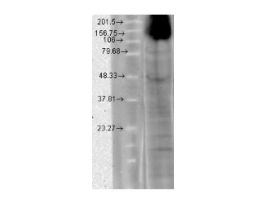 HCN4 ANTIBODY 100UG